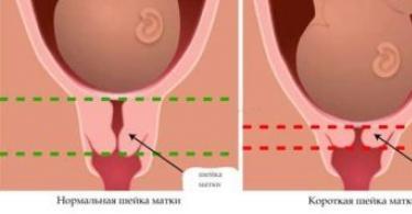 Перед родами: Основные медицинские термины родов Шейка матки расположение